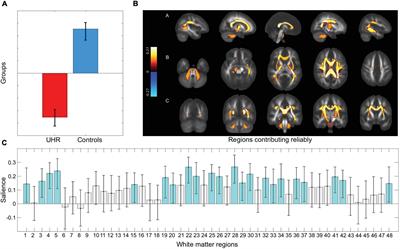White matter microstructure and sleep-wake disturbances in individuals at ultra-high risk of psychosis